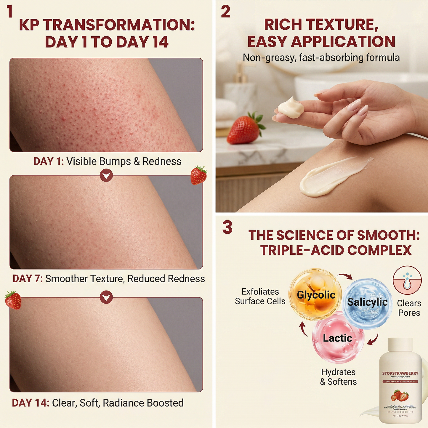 Keratosis Pilaris Resurfacing Cream